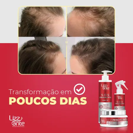 Transforme seus cabelos com o kit SOS Crescimento, e acabe com a queda capilar.